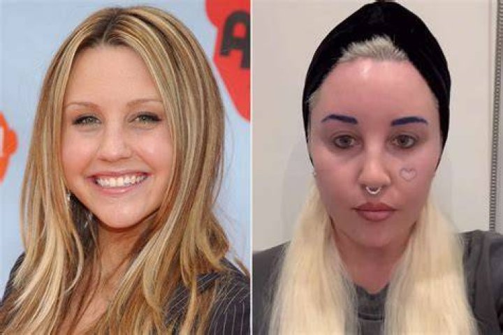 Amanda Bynes is one of many celebrities living under a conservatorship