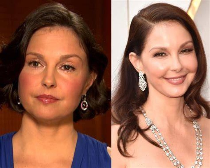 Did Ashley Judd Get Plastic Surgery? Transformation Photos Life & Style