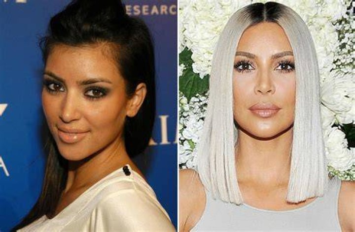 Does Kim Kardashian Have Any Implants?