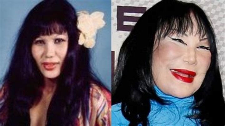 How Lyn May Plastic Surgery Destroyed her face