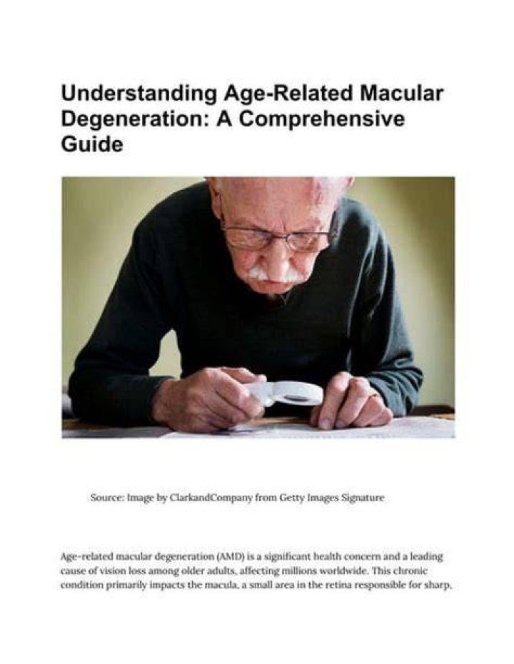 Understanding Age-related Manus: A Comprehensive Guide