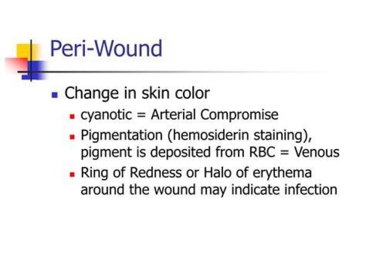 What Is Peri Wound Skin? (Solution found)