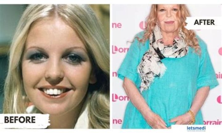 What Plastic Surgery has Sally Struthers gotten? Body Measurements